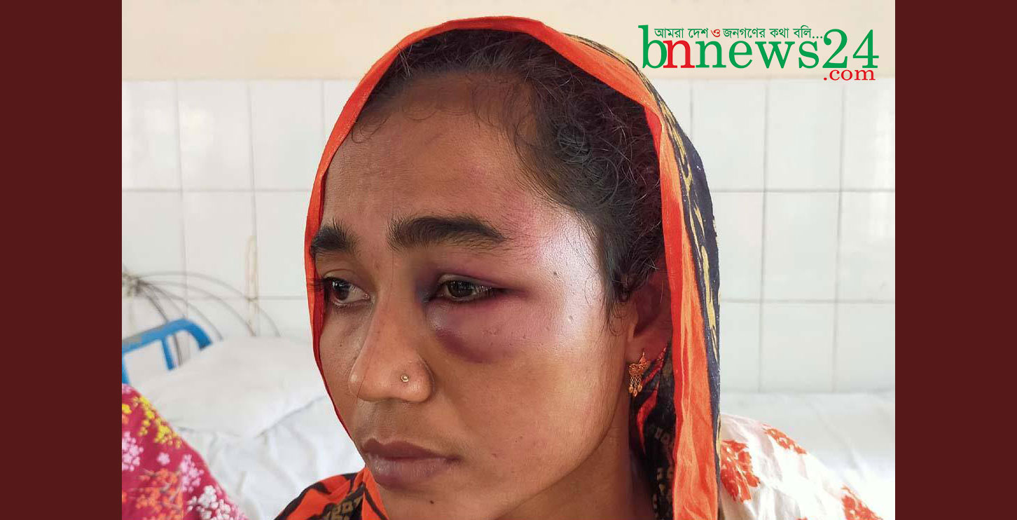 মণিরামপুরে সাবেক স্বামীর হাতে তালাকপ্রাপ্তা স্ত্রী মারপিটের শিকার