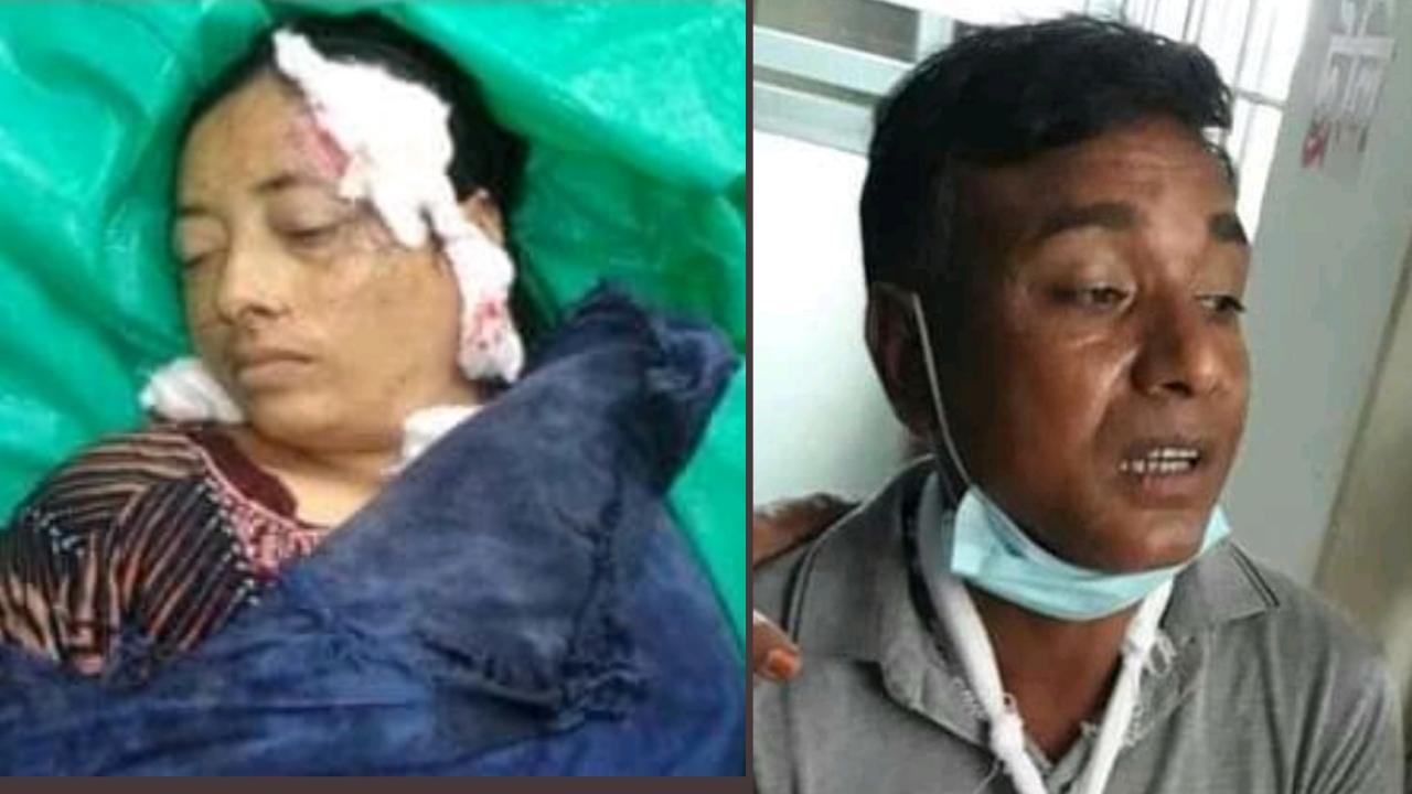 চৌগাছায় সড়ক দুর্ঘটনায় স্ত্রী নিহত স্বামী আহত