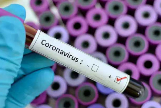 য‌শো‌রে এ পর্যন্ত তিন হাজার ৭৭১ জনের করোনা শনাক্ত