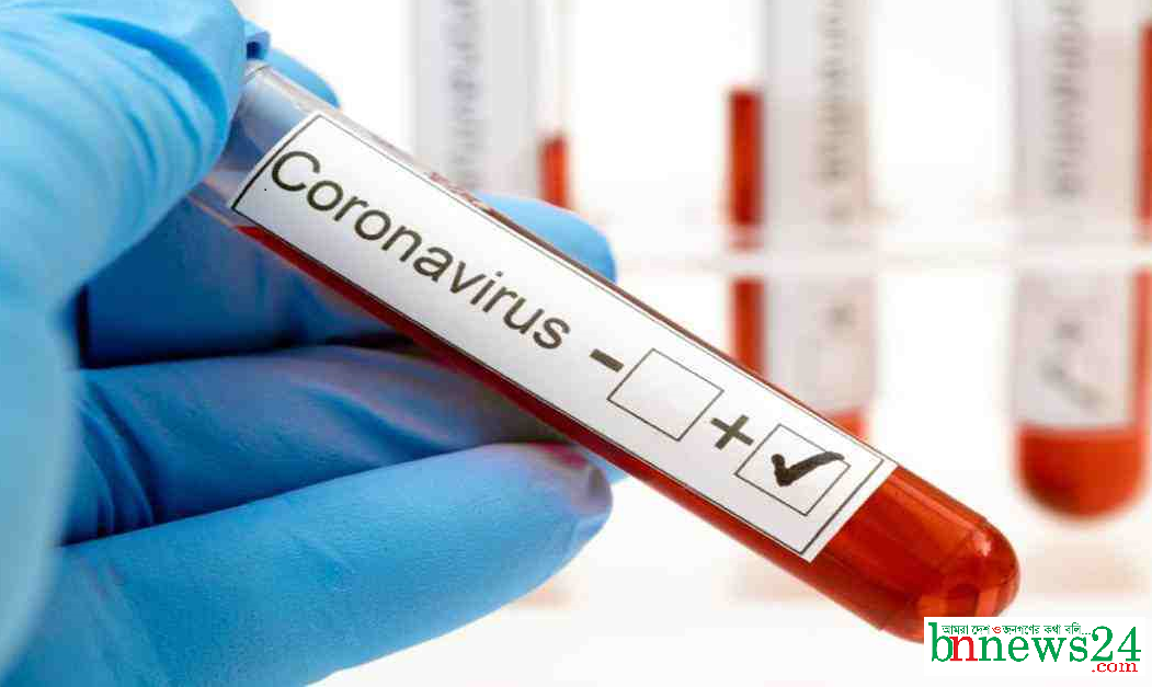 যবিপ্রবি জেনোম সেন্টারে আরো ১৮টি জনের পজেটিভ