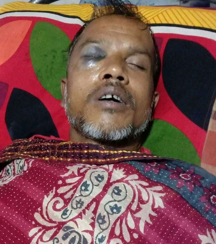 মণিরামপুরে আ’লীগ-যুবলীগের দুই গ্রুপের সংঘর্ষে ৫ জন আহত