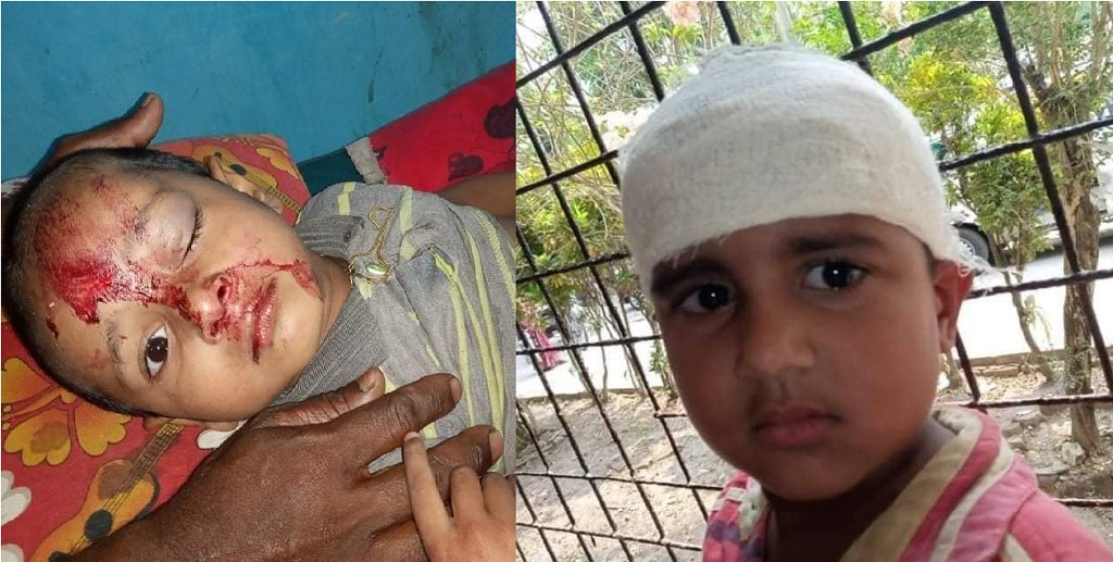 কোটালীপাড়ায় গাছ পড়ে পাঠশালার শিক্ষকসহ ২০ শিশু আহত