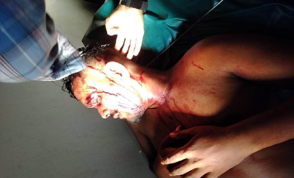 শার্শায় চা পান করাকে কেন্দ্র করে যুবককে পেটাল সন্ত্রাসীরা